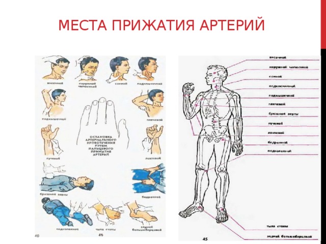 Места прижатия артерий