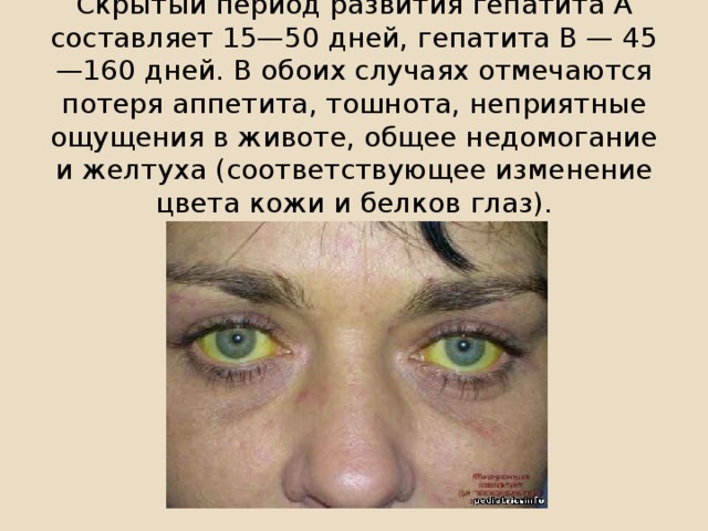 Скрытый период развития гепатита А составляет 15—50 дней, гепатита В — 45—160 дней. В обоих случаях отмечаются потеря аппетита, тошнота, неприятные ощущения в животе, общее недомогание и желтуха (соответствующее изменение цвета кожи и белков глаз).