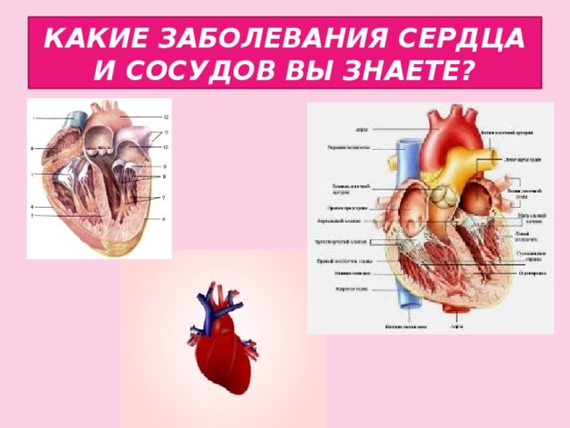 КАКИЕ ЗАБОЛЕВАНИЯ СЕРДЦА И СОСУДОВ ВЫ ЗНАЕТЕ?