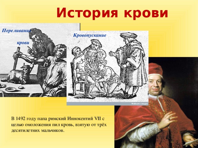 История крови Переливание  крови Кровопускание В 1492 году папа римский Иннокентий  VII  с целью омоложения пил кровь, взятую от трёх десятилетних мальчиков.