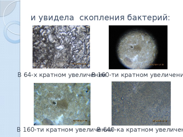 и увидела скопления бактерий: В 64-х кратном увеличении В 160-ти кратном увеличении В 160-ти кратном увеличении В 640-ка кратном увеличении