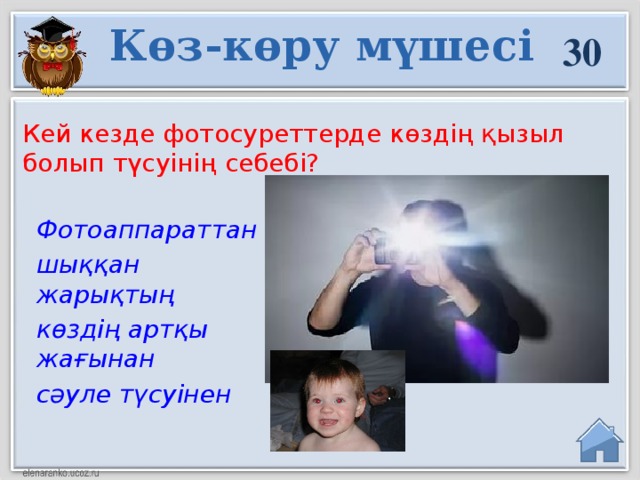 Көз-көру мүшесі 30 Кей кезде фотосуреттерде көздің қызыл болып түсуінің себебі? Фотоаппараттан шыққан жарықтың көздің артқы жағынан сәуле түсуінен