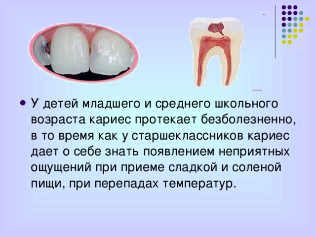 У детей младшего и среднего школьного возраста кариес протекает безболезненно, в то время как у старшеклассников кариес дает о себе знать появлением неприятных ощущений при приеме сладкой и соленой пищи, при перепадах температур.