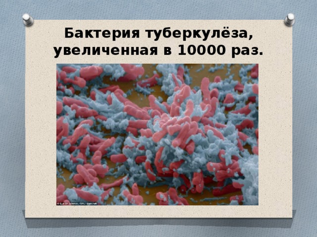 Бактерия туберкулёза, увеличенная в 10000 раз.