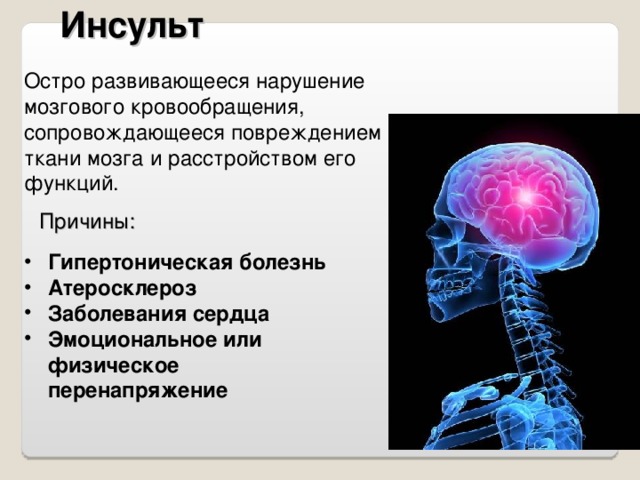 Инсульт Остро развивающееся нарушение мозгового кровообращения, сопровождающееся повреждением ткани мозга и расстройством его функций. Причины: