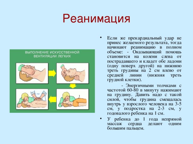 Реанимация Если же прекардиальный удар не принес желаемого результата, тогда начинают реанимацию в полном объеме: - Оказывающий помощь становится на колени слева от пострадавшего и кладет обе ладони (одну поверх другой) на нижнюю треть грудины на 2 см влево от средней линии (нижняя треть грудной клетки).  - Энергичными толчками с частотой 60-80 в минуту нажимают на грудину. Давить надо с такой силой, чтобы грудина смещалась внутрь у взрослого человека на 3-5 см, у подростка на 2-3 см, у годовалого ребенка на 1 см.