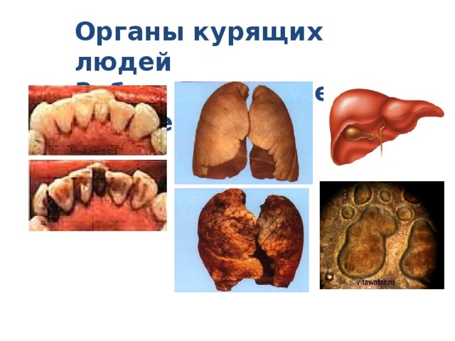 Органы курящих людей Зубы Лёгкие Печень