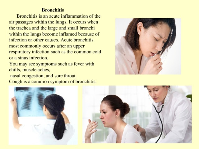 Bronchitis   Bronchitis is an acute inflammation of the air passages within the lungs. It occurs when the trachea and the large and small bronchi within the lungs become inflamed because of infection or other causes. Acute bronchitis most commonly occurs after an  upper respiratory infection such as the common cold or a sinus infection.  You may see symptoms such as fever with chills, muscle aches,  nasal congestion, and sore throat.  Cough is a common symptom of bronchitis.
