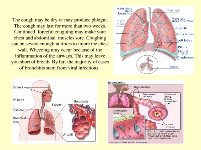 The cough may be dry or may produce phlegm. The cough may last for more than two weeks. Continued forceful coughing may make your chest and abdominal muscles sore. Coughing can be severe enough at s to injure the chest wall. Wheezing may occur because of the inflammation of the airways. This may leave you short of breath. By far, the majority of cases of bronchitis stem from viral infections.