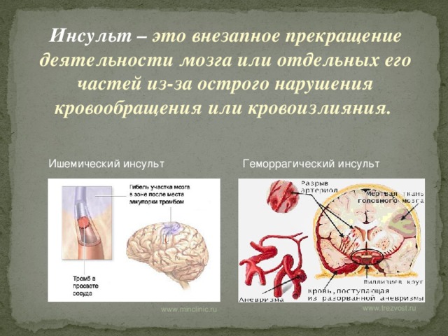 Инсульт  – это внезапное прекращение деятельности мозга или отдельных его частей из-за острого нарушения кровообращения или кровоизлияния. Ишемический инсульт Геморрагический инсульт www.trezvost.ru  www.minclinic.ru