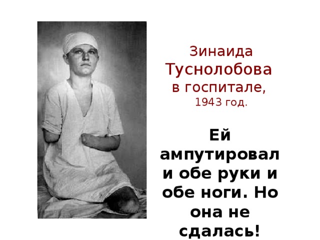 Зинаида Туснолобова в госпитале, 1943 год. Ей ампутировали обе руки и обе ноги. Но она не сдалась!
