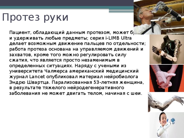 Протез руки  Пациент, обладающий данным протезом, может брать и удерживать любые предметы; серия i-LIMB Ultra делает возможным движение пальцев по отдельности; работа протеза основана на управляемом движений и захватов, кроме того можно регулировать силу сжатия, что является просто незаменимым в определенных ситуациях. Наряду с учеными из университета Чалмерса американский медицинский журнал Lancet опубликовал материал нейробиолога Эндрю Швартца. Парализованная 53-летняя женщина, в результате тяжелого нейродегенеративного заболевания не может двигать телом, начиная с шеи.