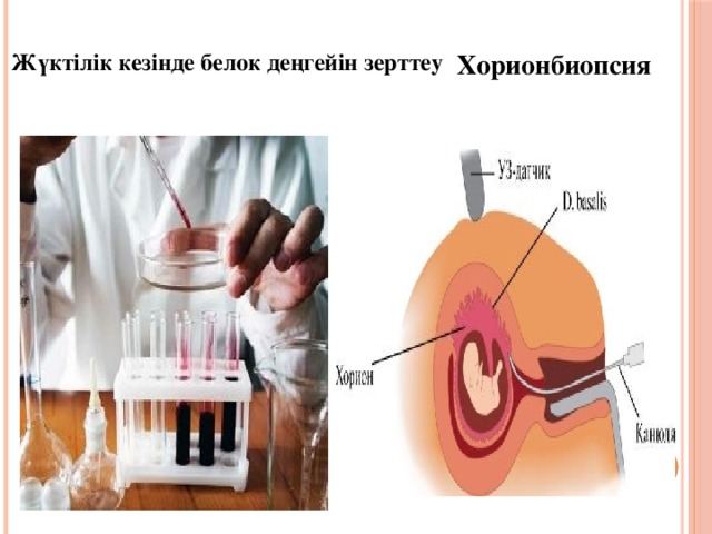 Жүктілік кезінде белок деңгейін зерттеу Хорионбиопсия