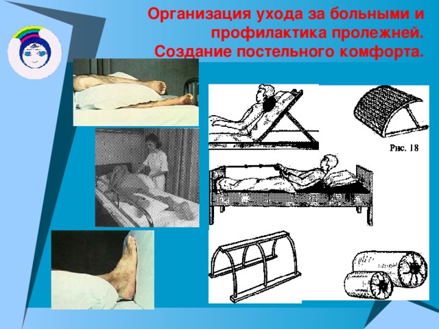 Организация ухода за больными и профилактика пролежней.  Создание постельного комфорта. 