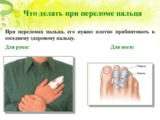 Что  делать  при  переломе  пальца При переломах пальца, его нужно плотно прибинтовать к соседнему здоровому пальцу.  Для руки: Для ноги: 9 