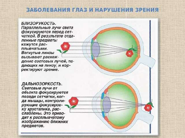 Заболевания глаз и нарушения зрения 