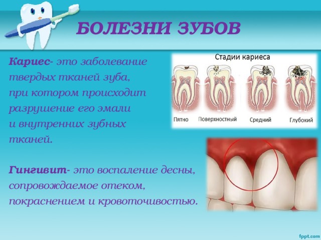 Проект на тему влияет ли зубная паста на прочность зубов