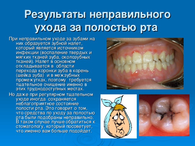 Результаты неправильного ухода за полостью рта  При неправильном уходе за зубами на них образуется зубной налет, который является источником  инфекции (воспаление твердых и мягких тканей зуба, околозубных тканей). Налет в основном  откладывается в  области перехода коронки зуба в корень (шейка зуба)  и в межзубных промежутках, поэтому  требуется тщательное очищение именно в этих труднодоступных местах. Но даже при регулярном тщательном уходе иногда  сохраняется неблагоприятное состояние полости рта. Это говорит о том, что средства по уходу за полостью рта были подобраны неправильно. В таком случае лучше обратиться к стоматологу, который посоветует, что именно вам больше подойдет.
