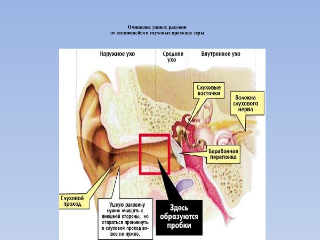 Очищение ушных раковин  от скопившейся в слуховых проходах серы