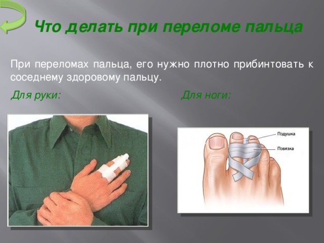 Что  делать  при  переломе  пальца При переломах пальца, его нужно плотно прибинтовать к соседнему здоровому пальцу.  Для руки: Для ноги: 7