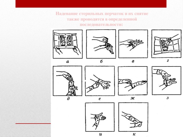 Надевание стерильных перчаток и их снятие также проводятся в определенной последовательности: